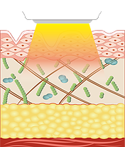 Eライト　光のみ